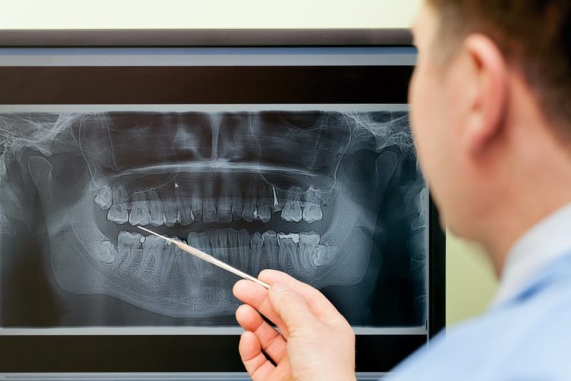 digital dental x-ray