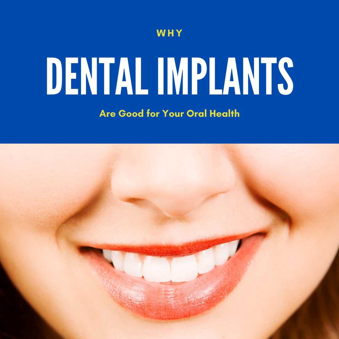 why-dental-implants-are-good-for-your-oral-health-digital-denture