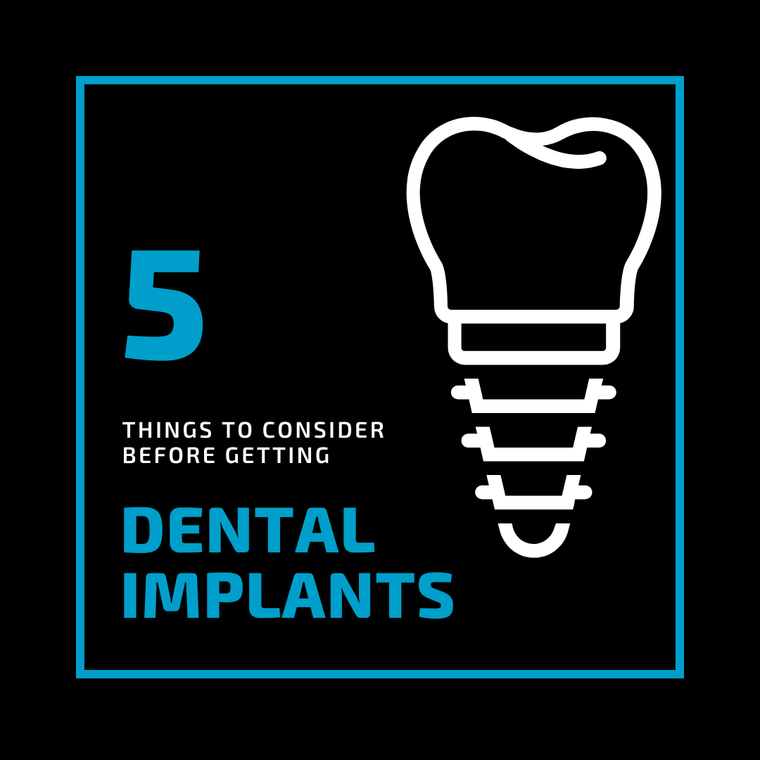 5 Things to Consider Before Getting Dental Implants