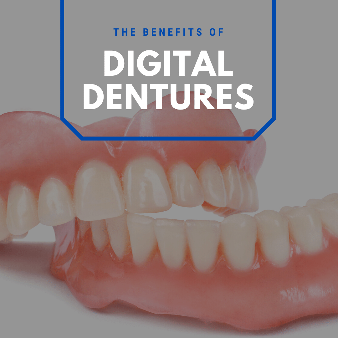 The Benefits of Digital Dentures